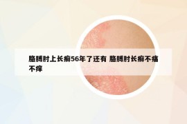 胳膊肘上長癬56年了還有 胳膊肘長癬不痛不癢