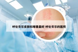 呼倫貝爾皮膚科哪里最好 呼倫貝爾的醫(yī)院
