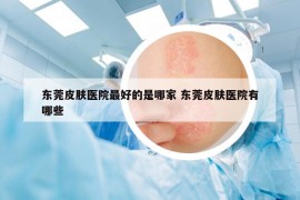 東莞皮膚醫(yī)院最好的是哪家 東莞皮膚醫(yī)院有哪些