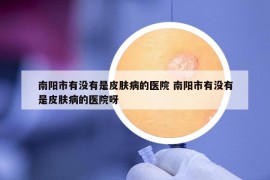 南陽市有沒有是皮膚病的醫(yī)院 南陽市有沒有是皮膚病的醫(yī)院呀