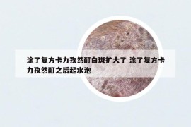 涂了復(fù)方卡力孜然酊白斑擴(kuò)大了 涂了復(fù)方卡力孜然酊之后起水泡