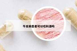 牛皮癬患者可以吃料酒嗎