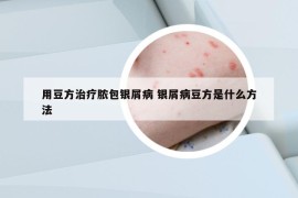 用豆方治療膿包銀屑病 銀屑病豆方是什么方法