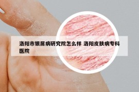 洛陽市銀屑病研究院怎么樣 洛陽皮膚病?？漆t(yī)院