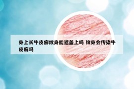 身上長牛皮癬紋身能遮蓋上嗎 紋身會(huì)傳染牛皮癬嗎
