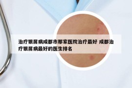 治療銀屑病成都市那家醫(yī)院治療最好 成都治療銀屑病最好的醫(yī)生排名
