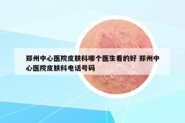 鄭州中心醫(yī)院皮膚科哪個(gè)醫(yī)生看的好 鄭州中心醫(yī)院皮膚科電話號(hào)碼