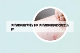 青島銀屑病專(zhuān)家門(mén)診 青島銀屑病研究院怎么樣
