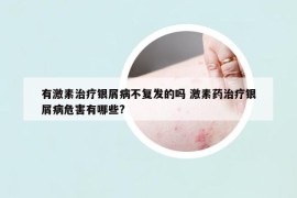 有激素治療銀屑病不復(fù)發(fā)的嗎 激素藥治療銀屑病危害有哪些?