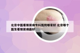 北京中醫(yī)看銀屑病專科醫(yī)院哪家好 北京哪個醫(yī)生看銀屑病最好