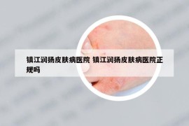 鎮(zhèn)江潤揚皮膚病醫(yī)院 鎮(zhèn)江潤揚皮膚病醫(yī)院正規(guī)嗎