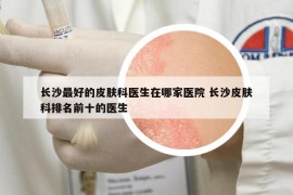 長(zhǎng)沙最好的皮膚科醫(yī)生在哪家醫(yī)院 長(zhǎng)沙皮膚科排名前十的醫(yī)生