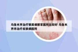 烏魯木齊治療銀屑病那家醫(yī)院比較好 烏魯木齊市治療皮膚病醫(yī)院