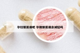 孕婦銀屑病吧 孕期銀屑病會(huì)減輕嗎