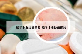 脖子上有塊癬圖片 脖子上有塊癬圖片