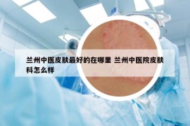 蘭州中醫(yī)皮膚最好的在哪里 蘭州中醫(yī)院皮膚科怎么樣