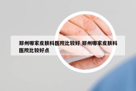 鄭州哪家皮膚科醫(yī)院比較好 鄭州哪家皮膚科醫(yī)院比較好點(diǎn)