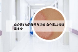 白介素17a的作用與功效 白介素17價格是多少