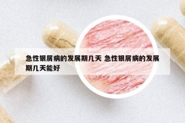 急性銀屑病的發(fā)展期幾天 急性銀屑病的發(fā)展期幾天能好