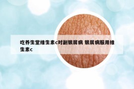吃養(yǎng)生堂維生素c對副銀屑病 銀屑病服用維生素c