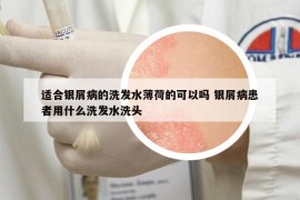 適合銀屑病的洗發(fā)水薄荷的可以嗎 銀屑病患者用什么洗發(fā)水洗頭