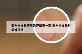 鄭州市皮膚醫(yī)院最好是哪一家 鄭州市皮膚科最好醫(yī)院