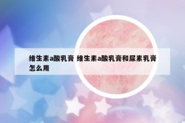 維生素a酸乳膏 維生素a酸乳膏和尿素乳膏怎么用