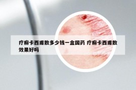療癬卡西甫散多少錢(qián)一盒國(guó)藥 療癬卡西甫散效果好嗎