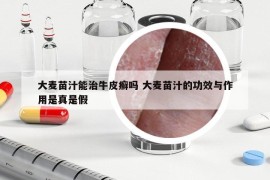 大麥苗汁能治牛皮癬嗎 大麥苗汁的功效與作用是真是假