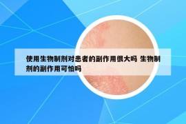 使用生物制劑對患者的副作用很大嗎 生物制劑的副作用可怕嗎