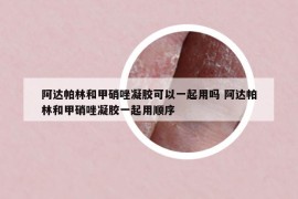 阿達帕林和甲硝唑凝膠可以一起用嗎 阿達帕林和甲硝唑凝膠一起用順序