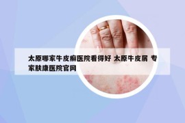 太原哪家牛皮癬醫(yī)院看得好 太原牛皮屑 專家膚康醫(yī)院官網(wǎng)