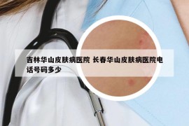 吉林華山皮膚病醫(yī)院 長春華山皮膚病醫(yī)院電話號碼多少