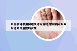 銀屑病可以用阿道夫沐浴露嗎 銀屑病可以用阿道夫沐浴露嗎女生