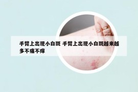 手臂上出現(xiàn)小白斑 手臂上出現(xiàn)小白斑越來越多不痛不癢