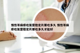 慢性蕁麻疹吃氯雷他定片要吃多久 慢性蕁麻疹吃氯雷他定片要吃多久才能好