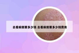 去看癬需要多少錢 去看癬需要多少錢費用
