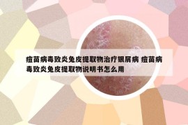 痘苗病毒致炎兔皮提取物治療銀屑病 痘苗病毒致炎兔皮提取物說明書怎么用