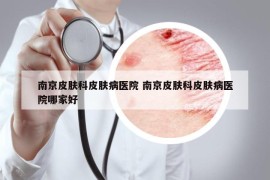 南京皮膚科皮膚病醫(yī)院 南京皮膚科皮膚病醫(yī)院哪家好