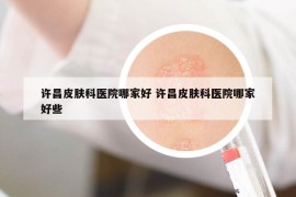 許昌皮膚科醫(yī)院哪家好 許昌皮膚科醫(yī)院哪家好些