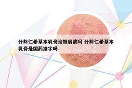 什邦仁希草本乳膏治銀屑病嗎 什邦仁希草本乳膏是國藥準(zhǔn)字嗎