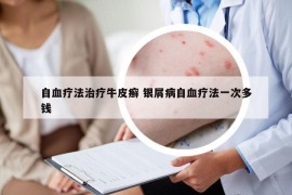 自血療法治療牛皮癬 銀屑病自血療法一次多錢