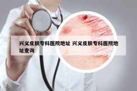 興義皮膚?？漆t(yī)院地址 興義皮膚?？漆t(yī)院地址查詢