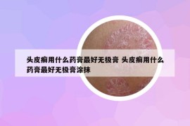 頭皮癬用什么藥膏最好無極膏 頭皮癬用什么藥膏最好無極膏涂抹