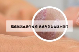 鍋底灰怎么治牛皮癬 鍋底灰怎么去除小竅門