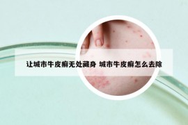 讓城市牛皮癬無處藏身 城市牛皮癬怎么去除