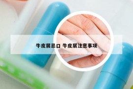 牛皮屑忌口 牛皮屑注意事項