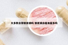 大多數(shù)會得銀屑病嗎 銀屑病會越來越多嗎