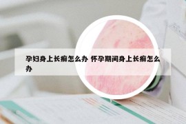 孕婦身上長癬怎么辦 懷孕期間身上長癬怎么辦