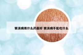 銀消病用什么藥最好 銀消病不能吃什么
